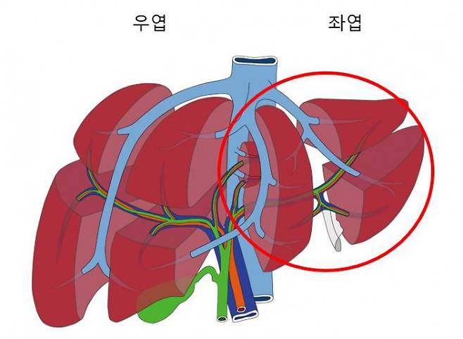 간의 좌엽과 우엽. 삼성서울병원 제공