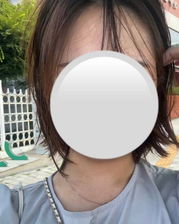 국내 유명 프렌차이즈 미용실에서 상당한 금액을 지불하고 한 파마가 요구했던 것과 달라 환불을 요구했지만, 회사 방침상 환불은 절대 불가능하다며 거절당했다는 소비자의 주장이 나왔다. 사진은 파마 시술 직후 머리 모습. [사진=이나연 씨 제공]