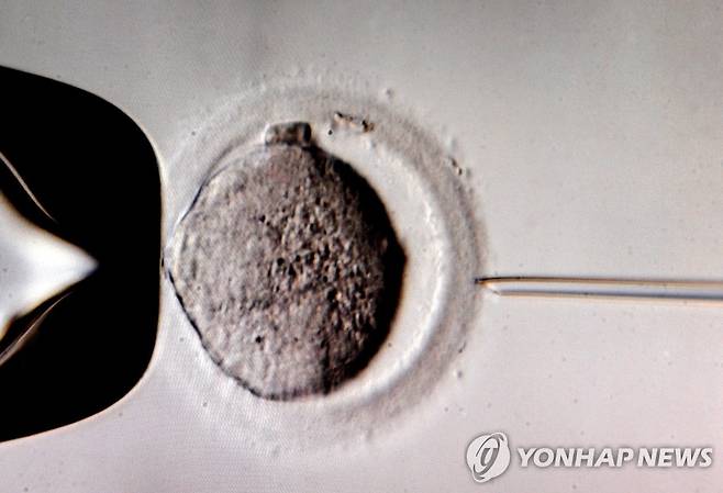 체외수정 [EPA 연합뉴스 자료사진. 재판매 및 DB 금지]