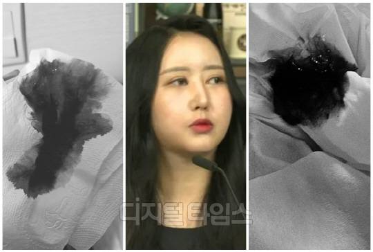 최서원씨(개명 전 최순실씨) 딸 정유라씨가 최근 자신의 SNS를 통해 피를 토한(객혈) 사진을 직접 공개해 정치권이 떠들썩하다. <디지털타임스 DB, 정유라 SNS>