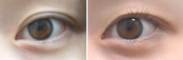 해결책은 눈 앞머리를 올려주는 것입니다.