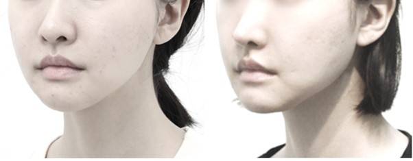 본시멘트는 딱딱한 플라스틱일 뿐입니다. 자연스러운 얼굴을 만들어주지 않습니다.