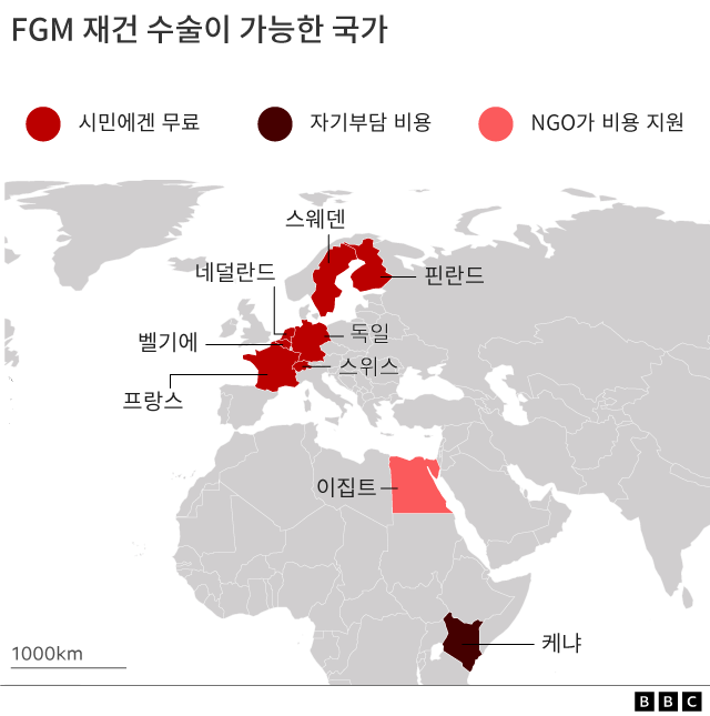 일부 유럽 국가에선 공공 의료 보험을 통해 FGM 재건 수술 비용을 지원하기도 한다