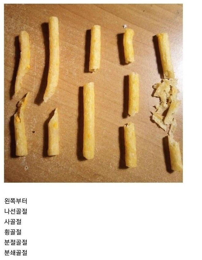 image-3.png 과자로 알아보는 골절의 종류.jpg