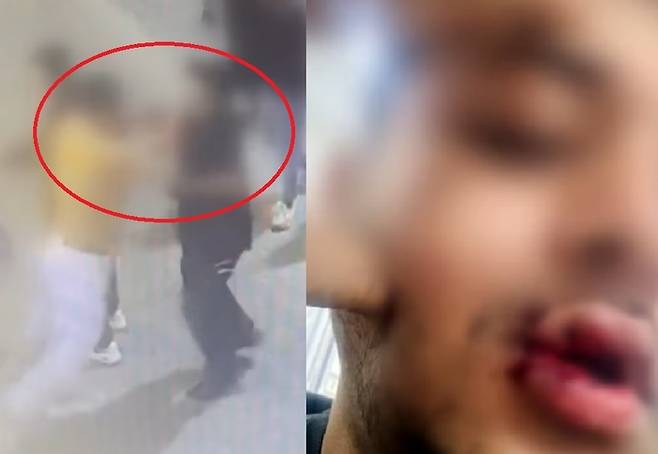 방글라데시에서 온 유학생이 방학 중 학비를 벌기 위해 아르바이트를 하다 폭행시비에 휘말려 다치는 일이 발생했다. [사진출처 = JTBC 영상 캡처]