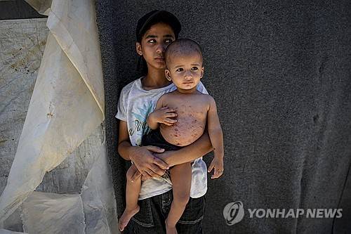 Israel Palestinians Skin Diseases