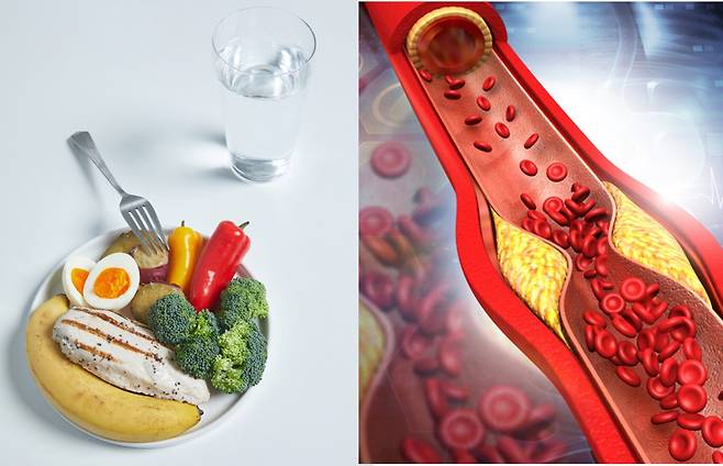 미국 하버드대 의대가 운영하는 건강의학매체 '하버드 헬스 퍼블리싱(Harvard Health Publishing)'에 따르면 음식을 바꾸면 콜레스테롤 수치를 낮추는 데 도움이 될 수 있으나, 그 영향은 썩 크지 않다. [사진=게티이미지뱅크]