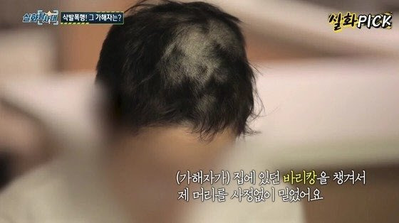 감금한 애인을 폭행·강간하고 바리캉으로 머리까지 민 20대 남성에게 검찰이 중형을 구형했다. 사진은 피해자 모습. MBC 캡처