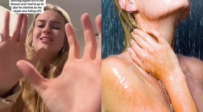 니플 피어싱 때문에 유두가 찢어진 틸리 예이츠/사진=더 선, 게티이미지뱅크