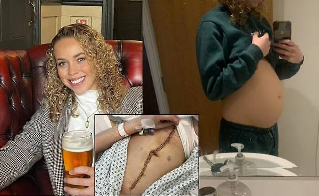 키샤 월든은 골반에 생긴 통증을 계속해서 호소했으나 의사가 별일 아니라고 치부해 결국 난소암 판정을 받고 난소와 자궁을 모두 제거하는 수술을 받았다. [사진='데일리메일' 보도내용 캡처]