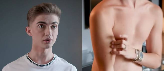 타일러는 이두근에 이식한 실리콘이 만지면 실제로 보이는 등의 부작용을 겪고 있다.​/사진=유튜브 채널 ‘truly’​