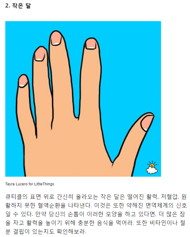 image.png 손톱 반달 모양으로 알아보는 건강상태 [스크롤 압박]