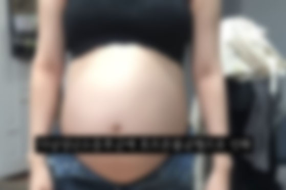 A woman shows her bloated belly in a video where she details her experience of terminating a nine-month pregnancy. [SCREEN CAPTURE]