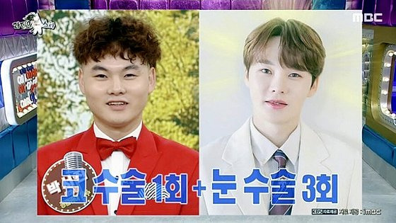 트로트 가수 박서진이 성형 비용으로 약 1억원을 썼다고 밝혔다. MBC 캡처