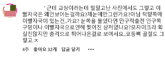 교상이 없다며, 의문을 먼저 제기한 건 유정씨의 SNS 친구들이었다. 반려견 보호자들이기도 했다./사진=라떼 구조자 김유정씨