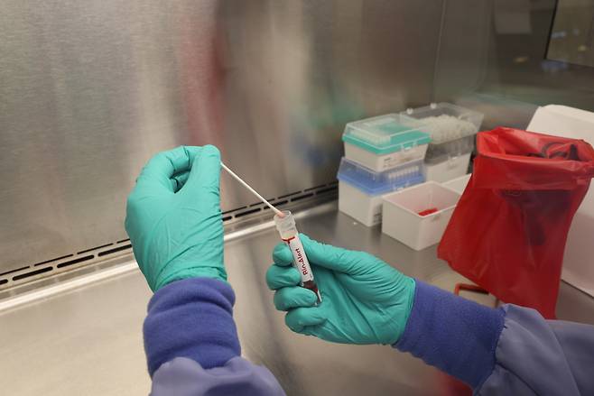 This file photo shows a medical worker testing a sample for mpox. (gettyimages)