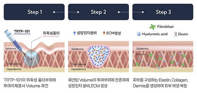 TRTP-101(피부재생치료제) 피부재생 작용기전. 셀인셀즈 제공