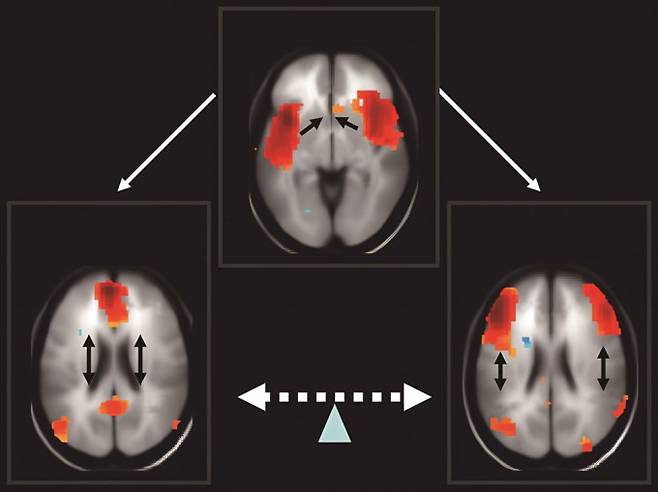 꿈꿀 때는 뇌에서 활성화되는 영역이 달라진다. 왼쪽에 해당하는 쉬는상태 신경망이 활성화되고 오른쪽에 해당하는 전두두정엽 신경망은 비활성화된다. Robert Melillo et al 제공