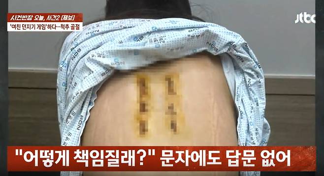 척추 골절 피해를 입은 A씨가 공개한 사진 / 사진=JTBC 사건반장 갈무리