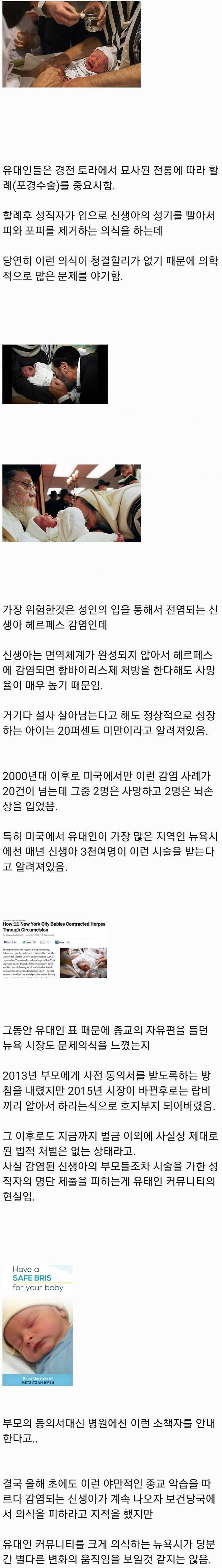 15.jpg 포경수술 후 사망하는 유대인 신생아들.jpg