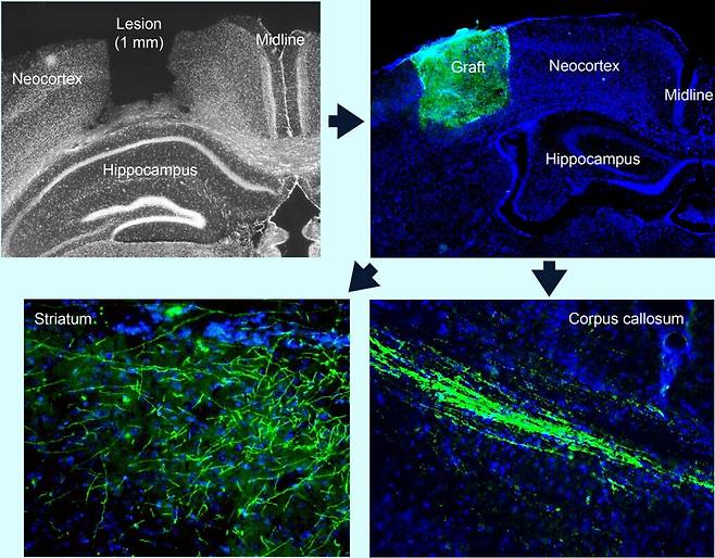 뇌 신피질에서 1mm 크기의 손상된 부위(왼쪽 위)에 줄기세포로 키운 조직(오른쪽 위 녹색)을 이식했다. 2주 안에 이식 조직에 혈관이 형성되고 신경세포로 자라 뇌량을 가로질러 반대쪽 대뇌 반구와 선조체까지 연결됐다(아래 좌우)./Bioengineering