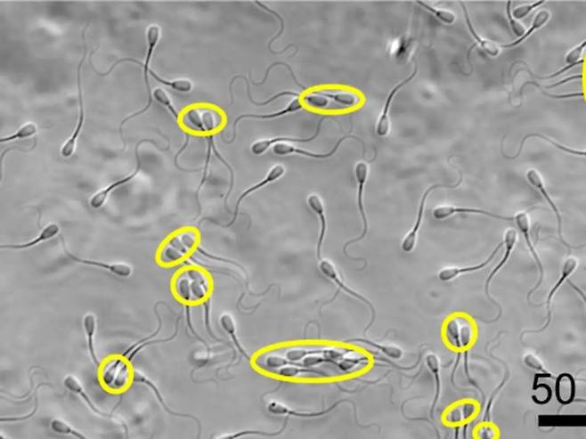 무리를 지어 이동하는 소 정자들(노란 타원 안)은 개별 정자보다 점도가 높은 체액이 흐르는 생식기 안에서 더 잘 이동할 수 있는 것으로 밝혀졌다./미 노스 캐롤라이나 농업기술주립대
