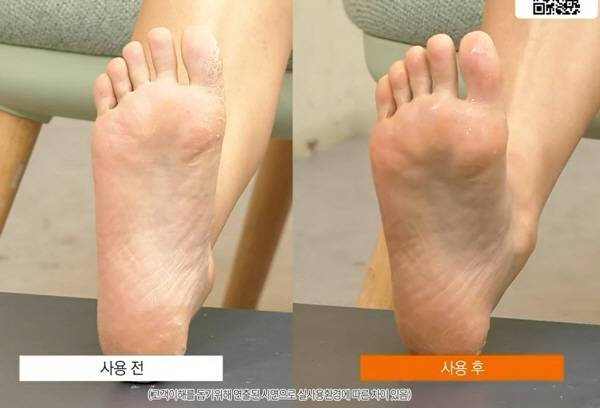 ▲ 각질제거제를 다룬 홈쇼핑 방송 장면 갈무리.