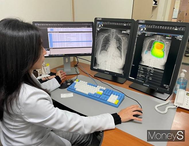 의료 AI 기업 루닛의 ‘루닛 인사이트 CXR’이 인천기독병원에서 사용되고 있다. 사진은 ‘루닛 인사이트 CXR’을 활용해 흉부 엑스레이를 판독하는 정선화 인천기독병원 진료협력센터장(영상의학과 전문의). /사진=김동욱 기자