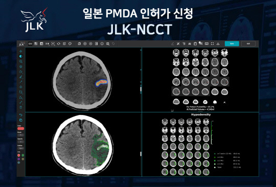 뇌졸중 AI 솔루션 'JLK-NCCT'. 제이엘케이 제공.