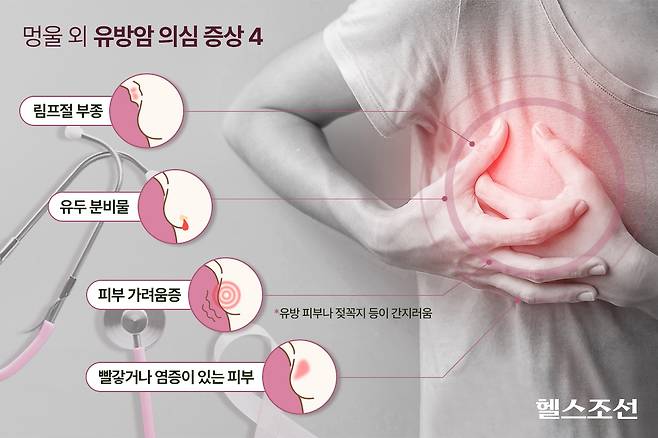 유방 피부나 젖꼭지 등 가슴 쪽 피부가 간지럽다면 유방암을 의심해 볼 수 있다/그래픽=김민선