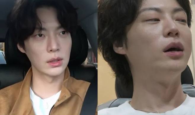 오늘 밤 11시 10분에 방송되는 MBC ‘나 혼자 산다’ (나혼산)에서는 배우 안재현이 사랑니 발치 과정을 통해 소소하지만 진솔한 일상을 공개한다. 갑작스러운 사랑니 문제로 치과를 찾은 안재현은 발치 전 복잡한 심경과 함께, 수술 부작용 안내를 듣고 잠시 패닉에 빠진 모습까지 보여준다. 발치 후에는 힘이 빠져 지친 표정과 부기 찜질을 하며 애환을 담은 일상으로 시청자들에게 웃음을 안길 예정이다. 반려묘 안주가 곁에서 그를 응원하는 모습이 더해져 훈훈한 분위기를 자아내며, 안재현이 사랑니와 이별하기 전 '최후의 만찬'으로 선택한 음식도 어떤 것일지 호기심을 불러일으키고 있다.