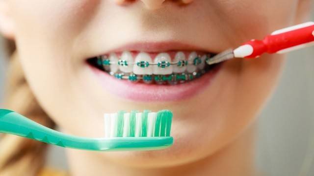 교정 장치를 부착하고 있다면 더욱 꼼꼼한 치아 관리가 필요하다｜출처: 게티이미지뱅크