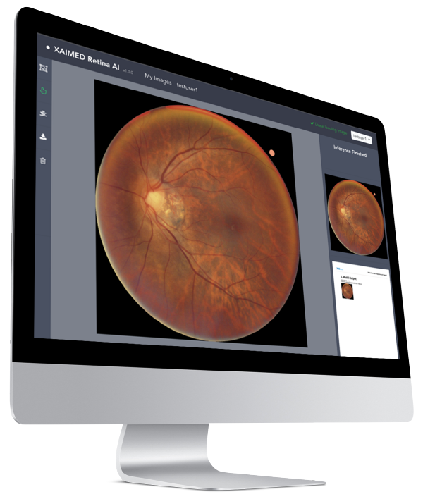 사진. 자이메드㈜ FUNDUS-CVD AI 제품