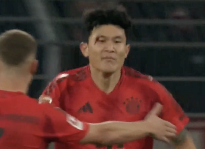 ▲ 김민재는 독일 도르트문트의 지그날 이두나 파크에서 열린 2024-25시즌 분데스리가 12라운드 도르트문트전에서 후반 80분까지 뮌헨의 수비를 책임지며 인상적인 활약을 펼쳤다. 뮌헨은 이 경기에서 1-1 무승부를 기록하며 리그 무패 행진을 이어갔다. 후반 80분 상대 선수와 볼 다툼 도중 팔꿈치에 얼굴을 맞아 눈썹 부위 출혈이 발생했다. 출혈로 인해 교체됐다. 경기 후 기자회견에서 김민재 컨디션에 대한 질문이 있었는데 “김민재는 눈썹 부위가 찢어져 몇 바늘 봉합했다. 하지만 김민재는 괴물 같은 선수다. 이런 부상은 그를 흔들지 못한다. 곧바로 출전 준비가 될 것”이라는 발표가 있었다