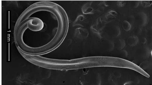 중국 여성의 눈에서 발견된 텔라지아 칼리파에다. 주로 농촌지역에서 드물게 나타나지만 애완동물과 접촉이 잦은 사람이 감염된 것으로 보고됐다. [사진=라이브 사이언스 캡쳐]