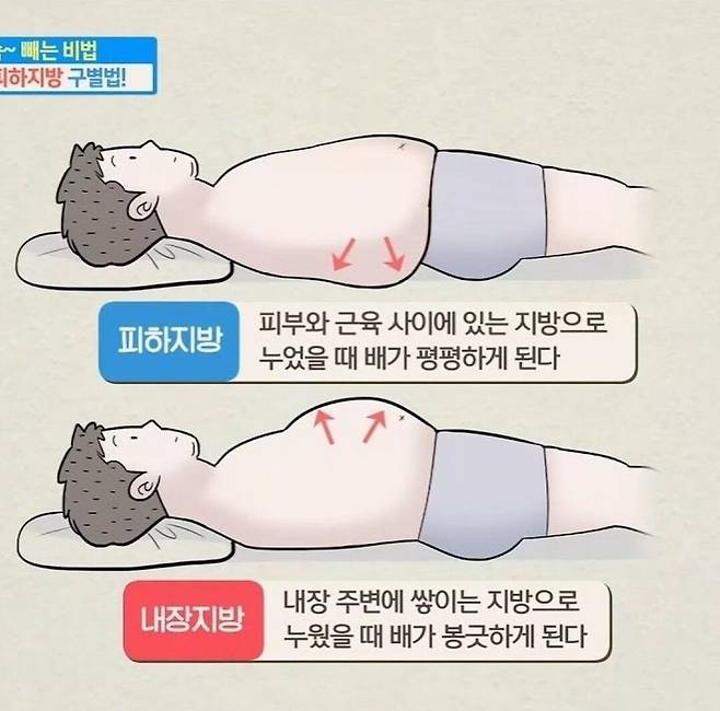 피하지방과 내장지방 차이