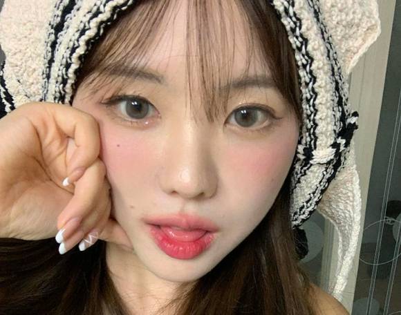 인플루언서 홍영기가 비상계엄이 선포된 상황에서 "내 몸이 더 비상"이라며 다이어트 보조제 홍보 글을 올려 누리꾼들의 질타를 받고 있다. [사진=홍영기 인스타그램]