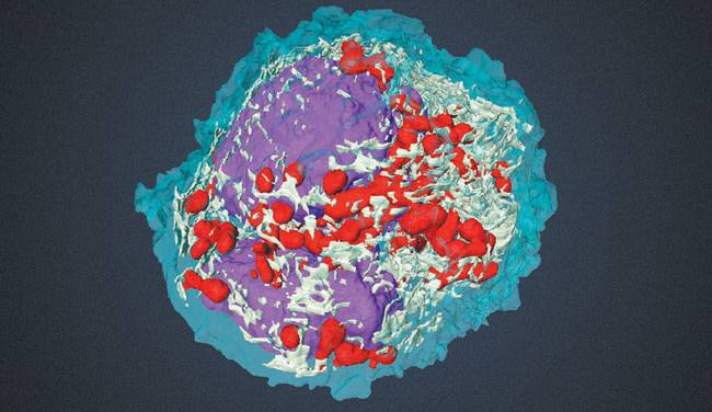 위 사진은 염증성 장 질환 환자의 장 조직 세포를 관찰한 결과 장 상피샘(점막 세포)의 화생(이미 분화를 끝낸 조직 세포가 다른 유형 세포로 변화하는 현상)을 보여주는 모습. 아래 사진은 HCA 컨소시엄이 2017년 새로 발견해 발표한 수지상 세포(면역세포의 일종).  네이처·HCA 컨소시엄 제공