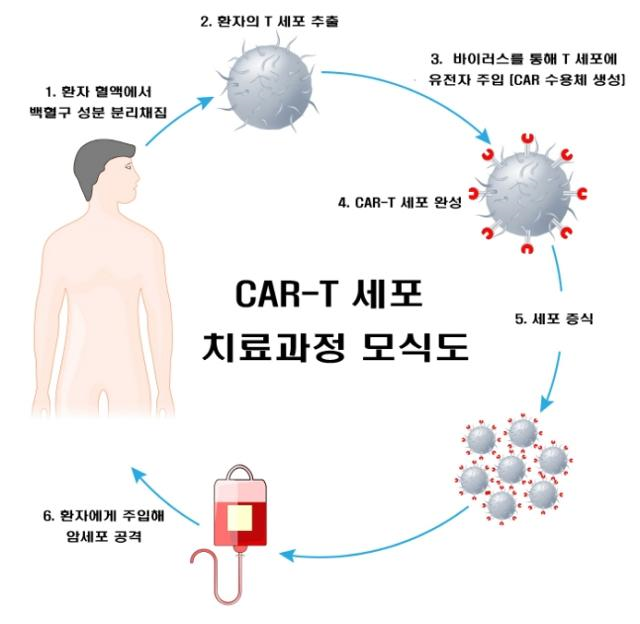 키메라 항원 수용체. 서울대병원