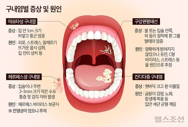 그래픽=김민선