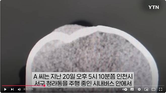 10개월 2.JPG 시내버스에서 생후 10개월된 아기에게 핸드폰 던져 중상 입힌 20대 여성