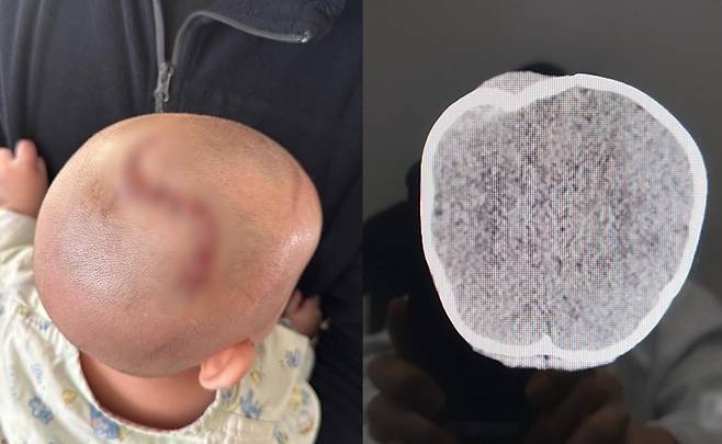 피해 아이의 친모 B씨가 공개한 사진./사진=SNS