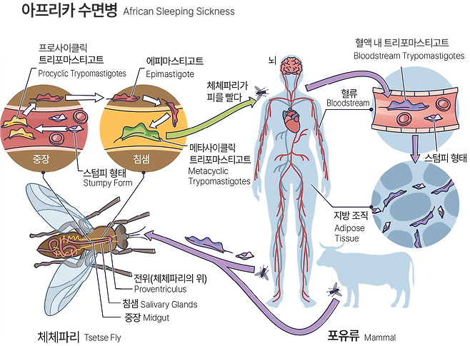 체체 파리에 의해 기생충에 감염돼 아프리카 수면병에 걸리는 과정 [용어 설명= 프로사이클릭 트리포마스티고트 : 체체파리의 중장에서 발견되는 트리파노소마 기생충의 형태로, 빠르게 증식하는 단계. 에피마스티고트 : 체체파리의 침샘으로 이동한 기생충의 형태로, 감염력이 없는 중간 단계. 중장 : 체체파리의 소화기관 중 하나로, 기생충이 처음 들어가 증식하는 장소. 스텀피 형태 : 감염된 숙주(인간 또는 동물)에서 체체파리가 기생충을 흡수할 때 발견되는 비활성화된 기생충 형태 메타사이클릭 트리포마스티고트 : 체체파리의 침샘에 위치하며, 숙주에게 감염을 일으킬 수 있는 기생충 형태. 혈액 내 트리포마스티고트 : 인간이나 동물 숙주의 혈류에서 발견되며, 활발히 활동하며 증식을 일으키는 형태. 그래픽=게티이미지뱅크-코메디닷컴 편집 ]
