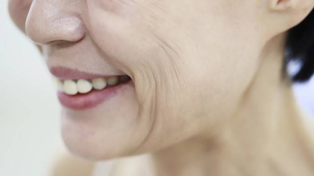 피부가 건조하고 탄력이 떨어졌다면 주름이 쉽게 생긴다｜출처: 클립아트코리아