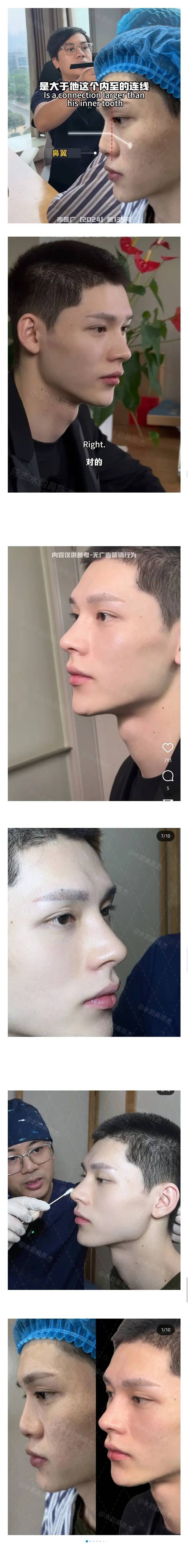 thumb_crop_resize.webp.ren.jpg 남자의 코성형