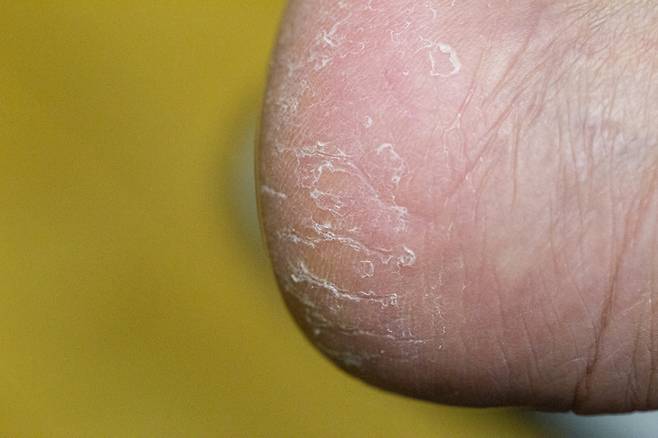 사진=게티이미지뱅크