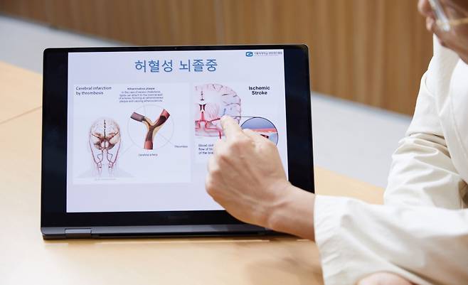 성빈센트병원 신경외과 이동훈 교수가 뇌졸중에 관해 설명하고 있다./사진=신지호 기자
