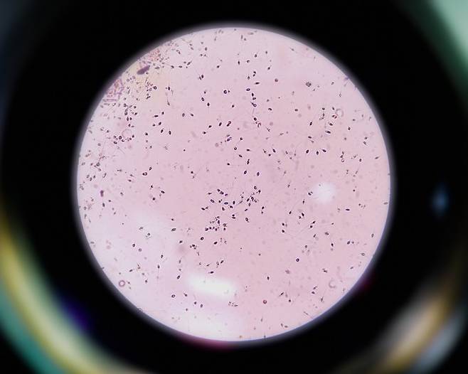 현미경으로 들여다본 정상적인 정자의 모습. 약 1억 5000만 마리의 정자 중 수정에 이르는 정자는 처음 난자에 도달한 정자가 아니라 처음 난자의 투명대를 녹이고 난자 내부까지 진출한 정자다. 게티이미지뱅크 제공