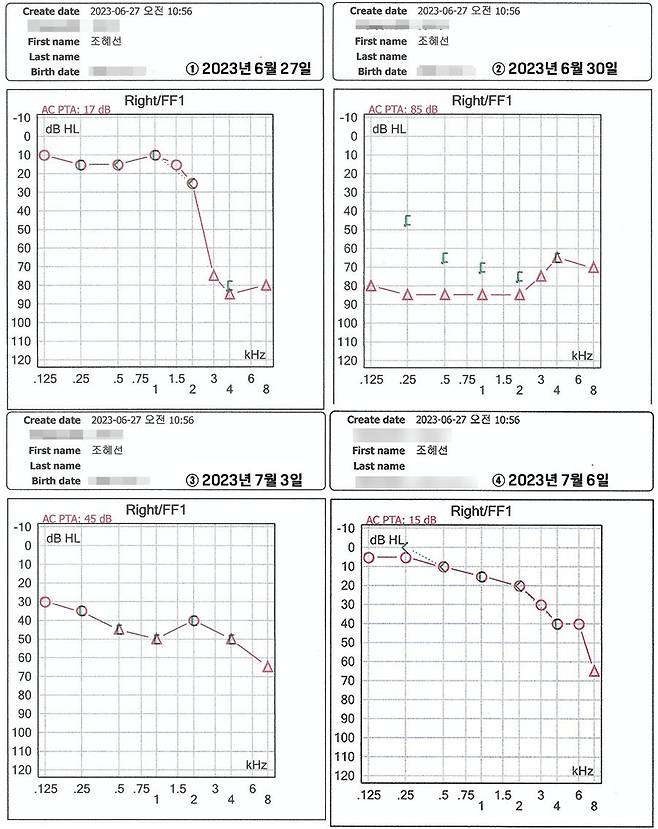 실제 청력검사 결과지. 첫 진료인 6월 27일 검사에서 청력이 일부 떨어진 것을 확인할 수 있다. 30일 검사에선 청력이 확연하게 상실됐다. 하지만 치료를 받은 뒤 청력은 점차 회복됐다. 데시벨(dB)은 소리의 크기, 헤르츠(k㎐)는 소리의 높낮이를 말한다. 청력도는 X축에 소리의 높낮이와 관련한 주파수(125~8000k㎐)를, Y축은 소리의 크기와 관련 청력수준(0~120㏈)을 표시한다. X축은 저음에서 오른쪽으로 갈수록 고음으로, Y축은 큰소리에서 위로 올라갈수록 작은 소리를 의미한다.
