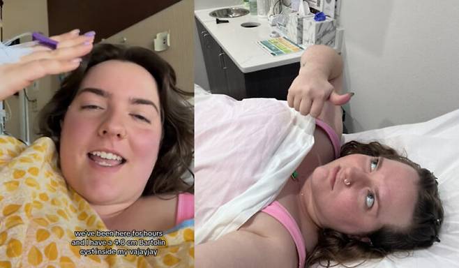 미국 텍사스주 댈러스에 사는 카엘라는 어느 날 아침 잠에서 깨어보니 속옷에 쓸려 질 주변에 상처가 생긴 것을 발견했다. [사진='니드투노우' 보도내용]